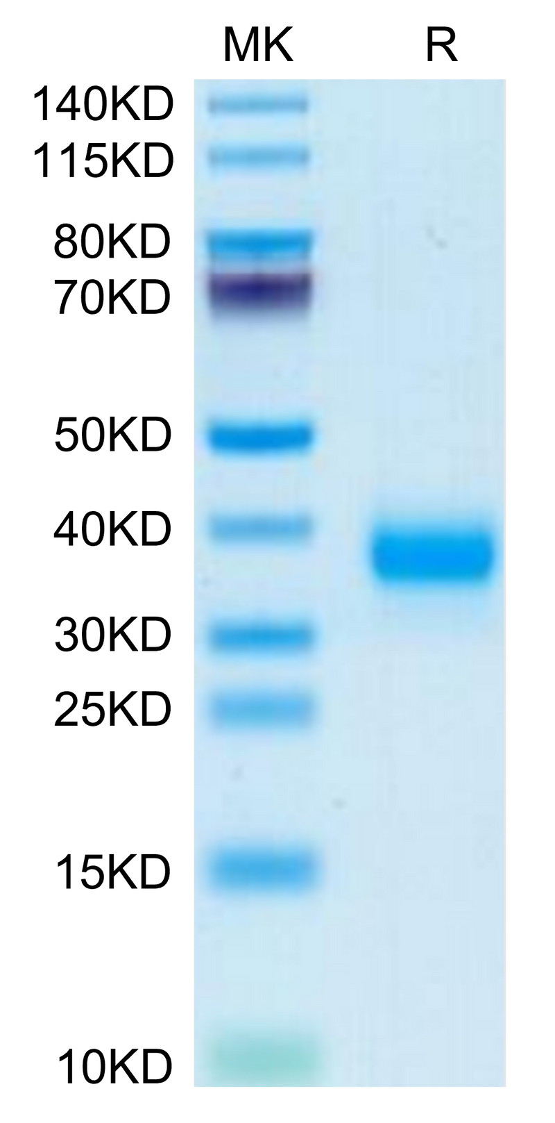 Mouse FOLR4/Juno on Tris-Bis PAGE under reduced condition. The purity is greater than 95%.Recombinant Mouse FOLR4/Juno Protein