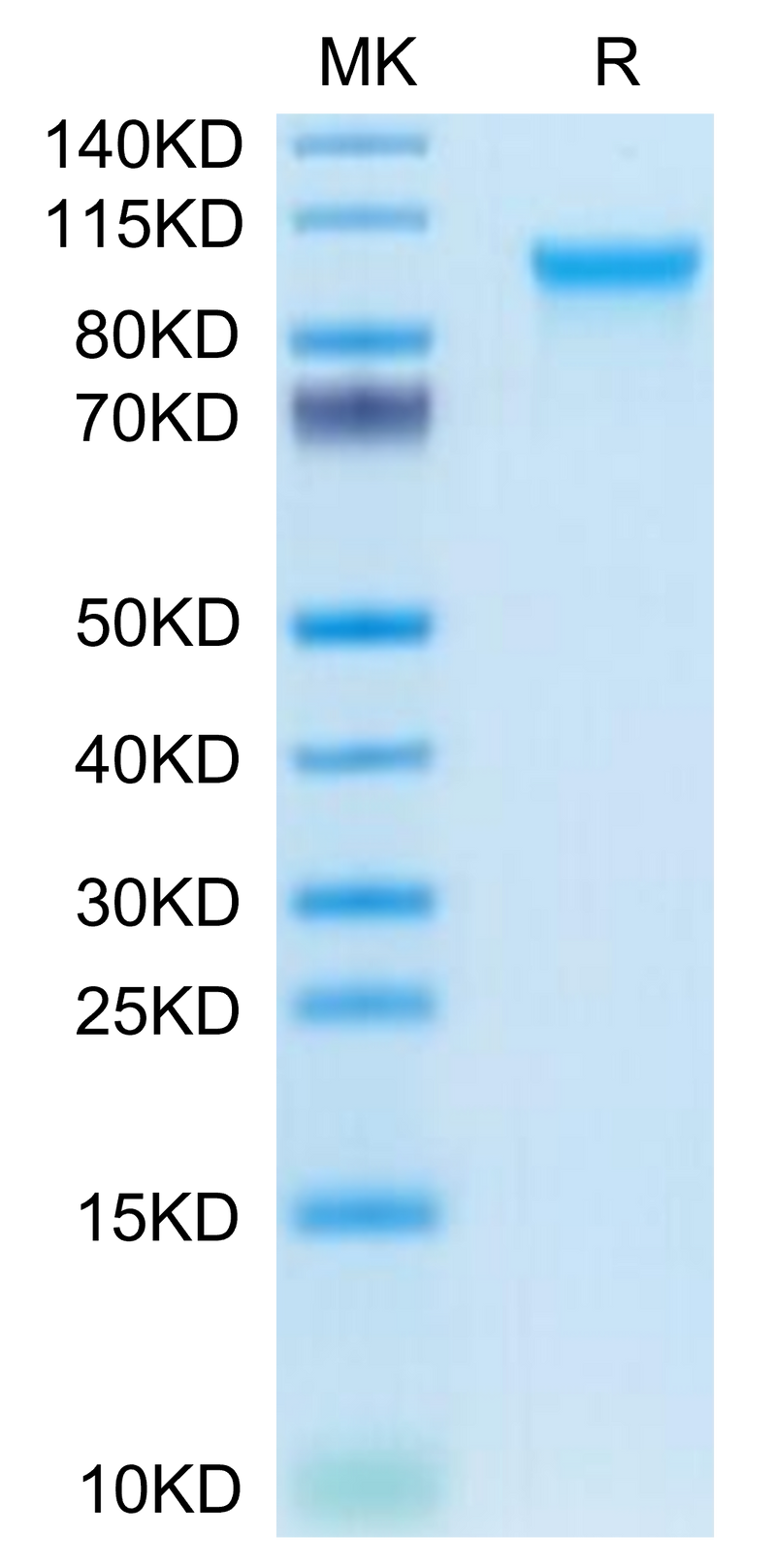Human CD93 on Tris-Bis PAGE under reduced condition. The purity is greater than 95%.Recombinant Human CD93/C1q R1 Protein, Active