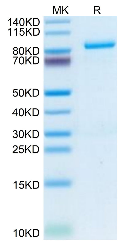Human Periostin on Tris-Bis PAGE under reduced condition. The purity is greater than 95%.Recombinant Human Periostin/OSF-2 Protein, Active