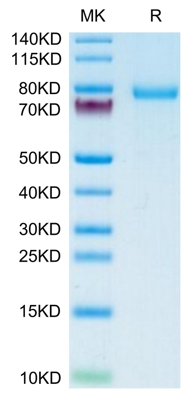 Human DSG-2 on Tris-Bis PAGE under reduced condition. The purity is greater than 95%.Recombinant Human DSG-2/Desmoglein-2 Protein, Active