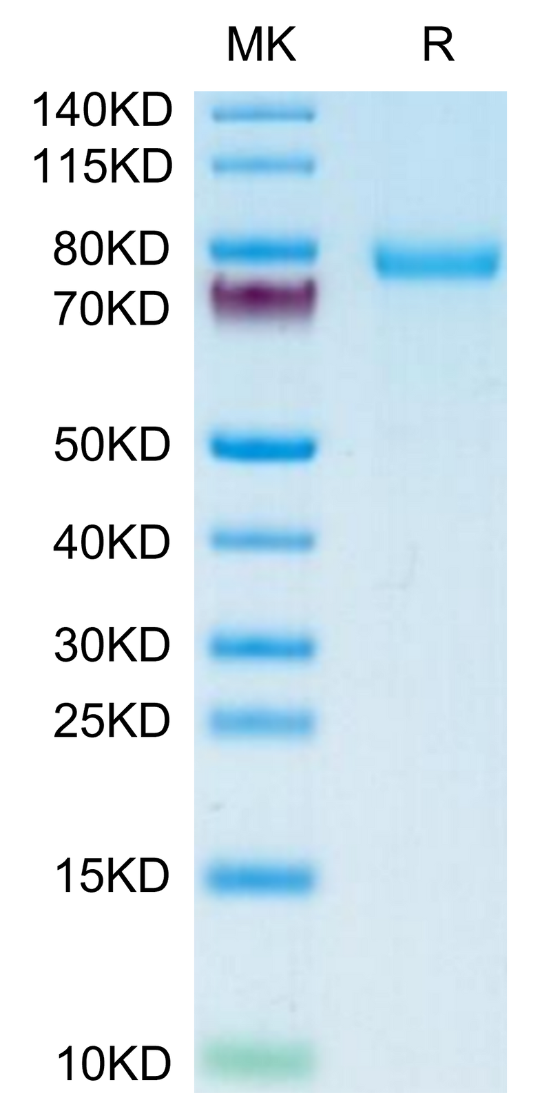 Human DSG-2 on Tris-Bis PAGE under reduced condition. The purity is greater than 95%.Recombinant Human DSG-2/Desmoglein-2 Protein, Active