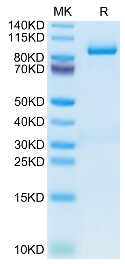 Mouse Periostin on Tris-Bis PAGE under reduced condition. The purity is greater than 95%.Recombinant Mouse Periostin/OSF-2 Protein