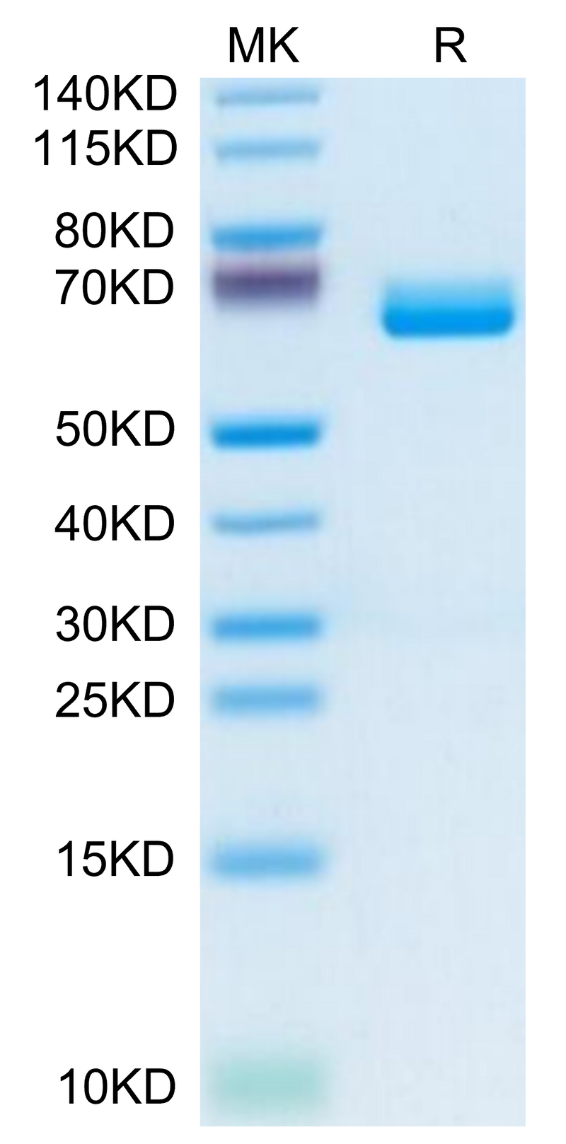 Mouse c-MPL/Thrombopoietin R on Tris-Bis PAGE under reduced condition. The purity is greater than 95%.Recombinant Mouse c-MPL/Thrombopoietin R Protein