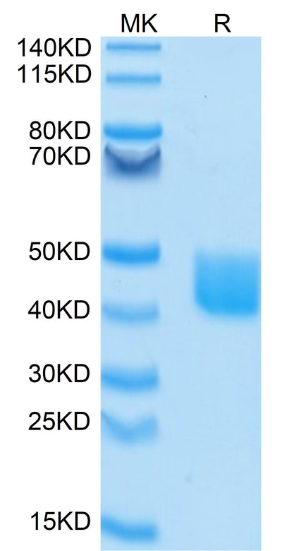 FITC-Labeled Human MSLN/Mesothelin on Tris-Bis PAGE under reduced condition. The purity is greater than 95%.Recombinant FITC-Labeled Human MSLN/Mesothelin Protein