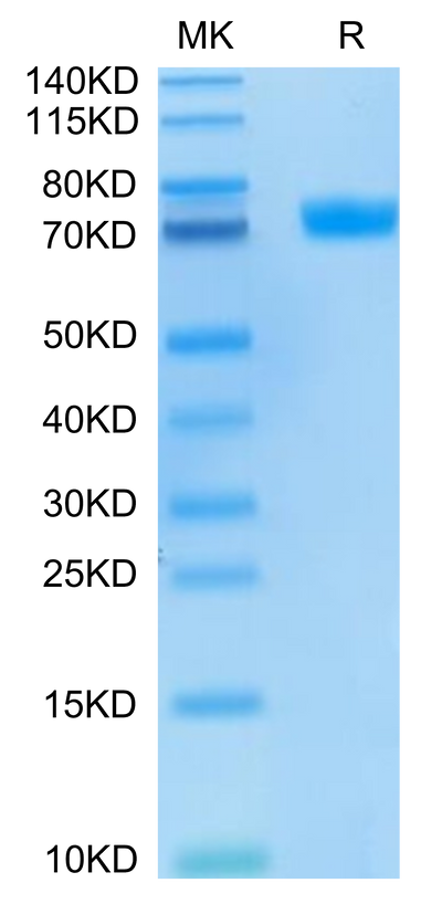 FITC-Labeled Human MSLN on Tris-Bis PAGE under reduced condition. The purity is greater than 95%.Recombinant FITC-Labeled Human MSLN/Mesothelin Protein