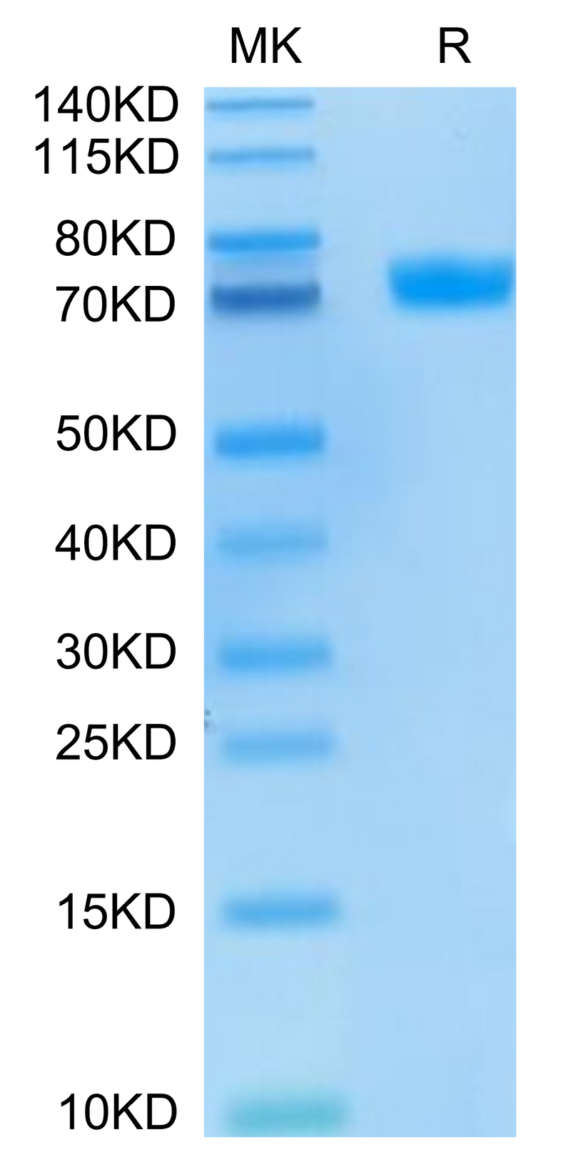 FITC-Labeled Human MSLN on Tris-Bis PAGE under reduced condition. The purity is greater than 95%.Recombinant FITC-Labeled Human MSLN/Mesothelin Protein