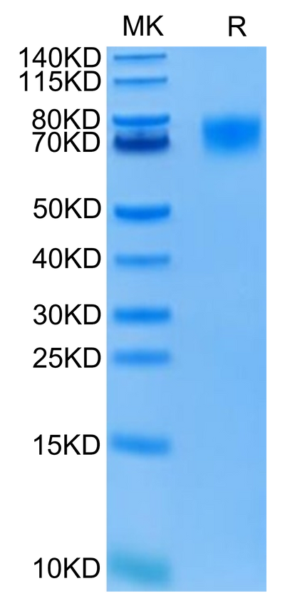 FITC-Labeled Human EGFRVIII on Tris-Bis PAGE under reduced condition. The purity is greater than 95%.Recombinant FITC-Labeled Human EGFRVIII Protein