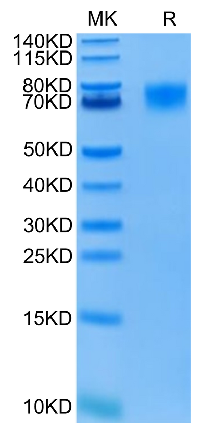 FITC-Labeled Human EGFRVIII on Tris-Bis PAGE under reduced condition. The purity is greater than 95%.