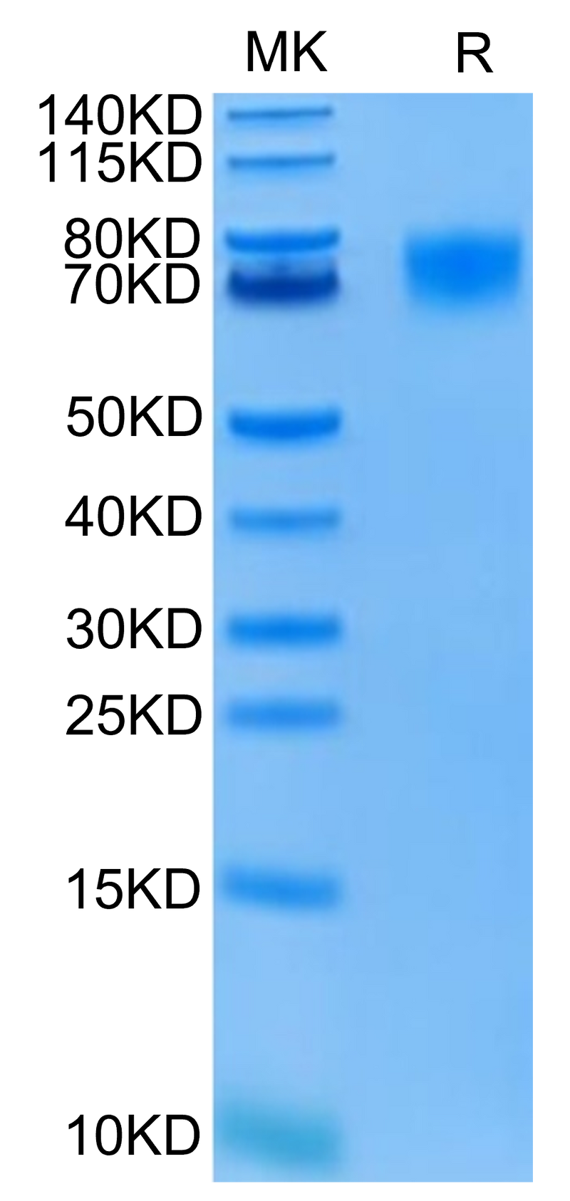 FITC-Labeled Human EGFRVIII on Tris-Bis PAGE under reduced condition. The purity is greater than 95%.Recombinant FITC-Labeled Human EGFRVIII Protein