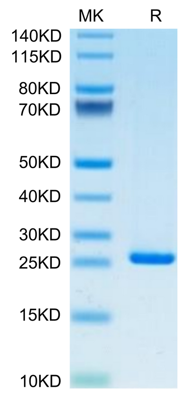 Human CRP on Tris-Bis PAGE under reduced condition. The purity is greater than 95%.Recombinant Human C-Reactive Protein /CRP Protein