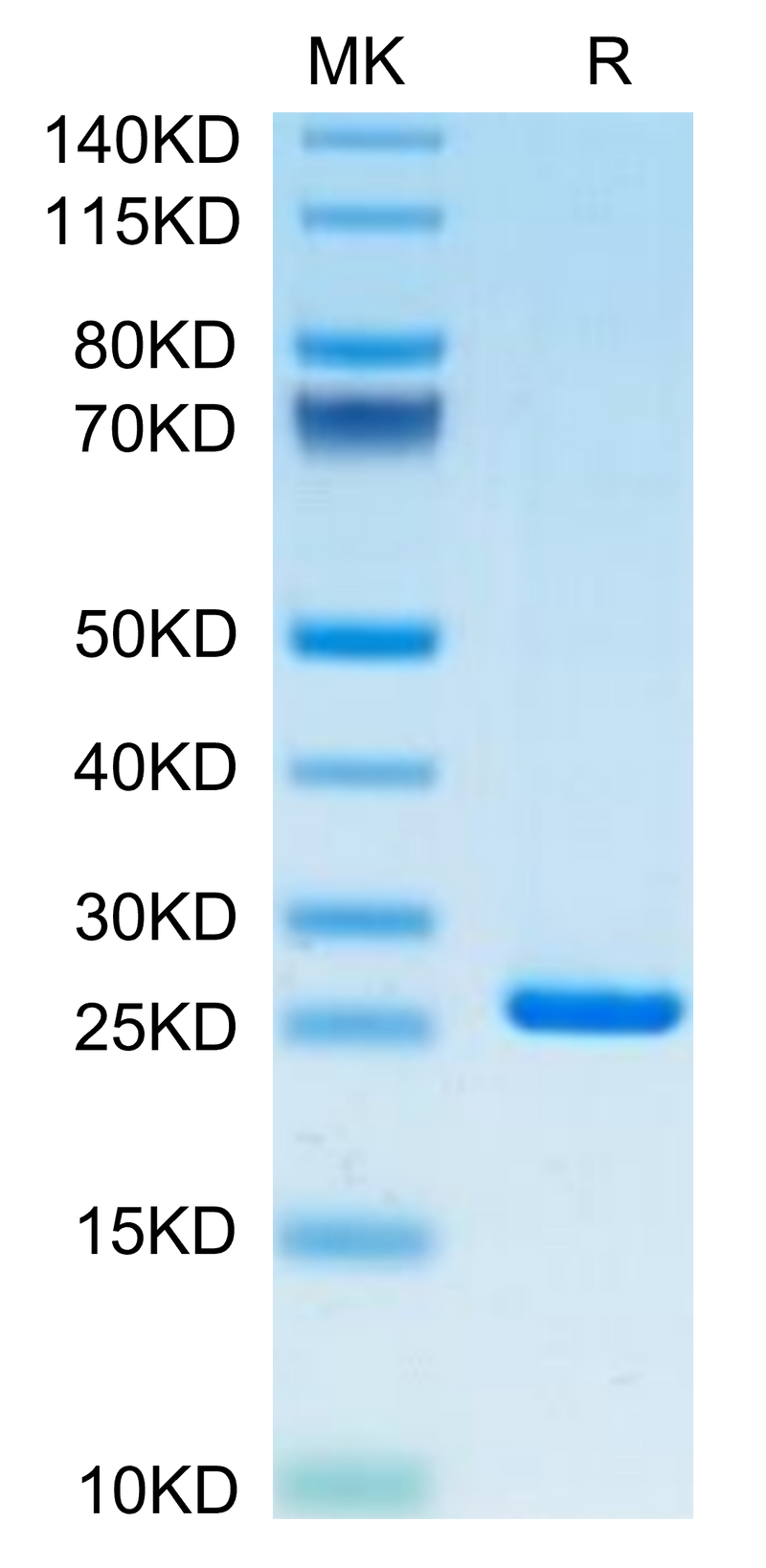 Human CRP on Tris-Bis PAGE under reduced condition. The purity is greater than 95%.Recombinant Human C-Reactive Protein /CRP Protein
