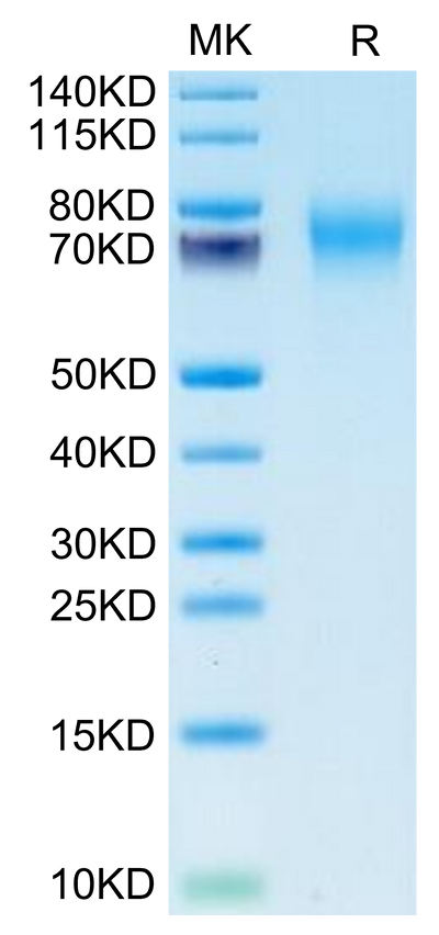 Biotinylated Human FGFR2 alpha (IIIc) on Tris-Bis PAGE under reduced condition. The purity is greater than 95%.Biotinylated Human FGFR2 alpha (IIIc) Protein
