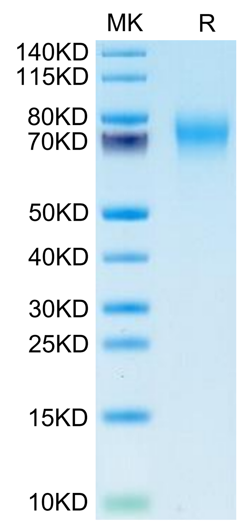 Biotinylated Human FGFR2 alpha (IIIc) on Tris-Bis PAGE under reduced condition. The purity is greater than 95%.Biotinylated Human FGFR2 alpha (IIIc) Protein