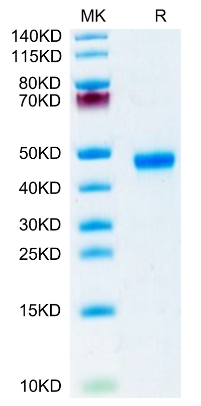 Mouse R spondin 1 on Tris-Bis PAGE under reduced condition. The purity is greater than 95%.Recombinant Mouse R spondin 1/RSPO1 Protein, Active