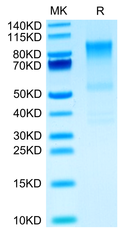 Mouse Syndecan-1 on Tris-Bis PAGE under reduced condition. The purity is greater than 90%.Recombinant Mouse Syndecan-1 Protein