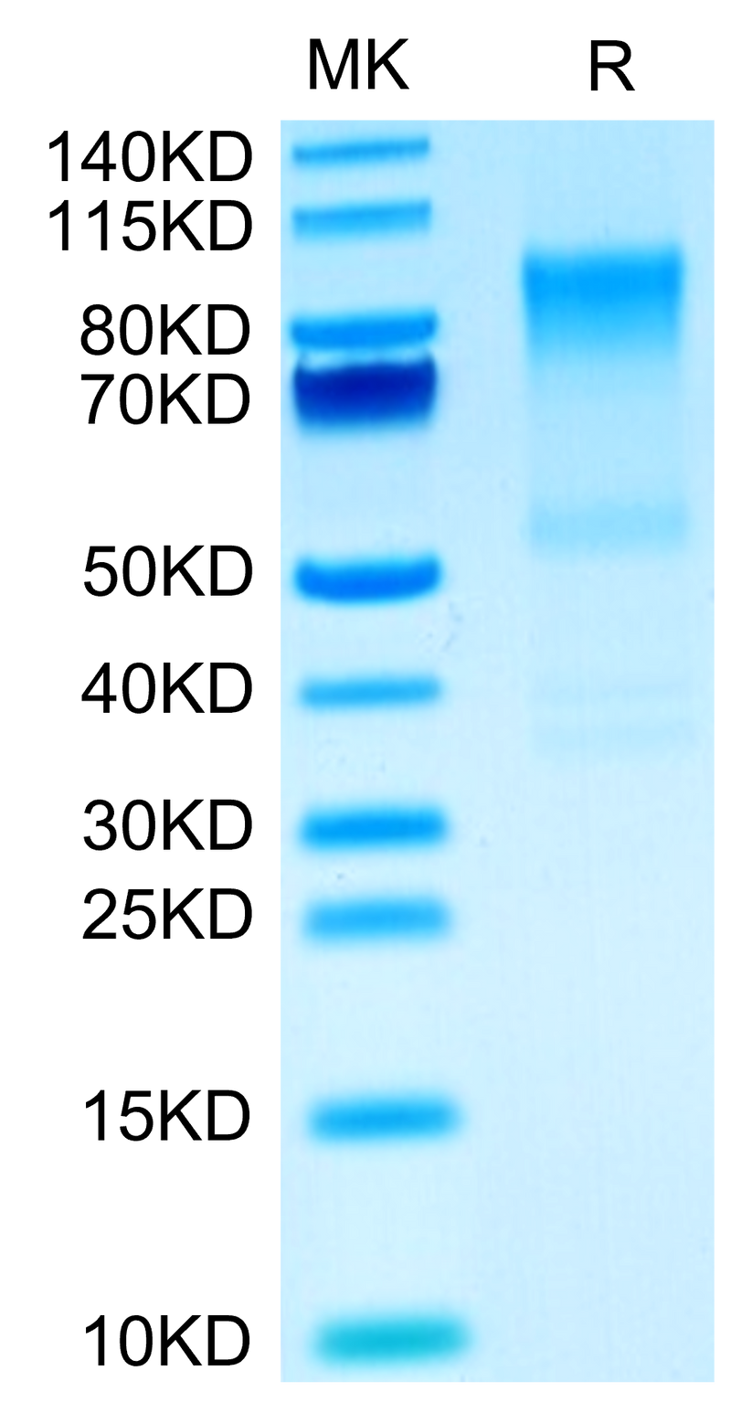 Mouse Syndecan-1 on Tris-Bis PAGE under reduced condition. The purity is greater than 90%.Recombinant Mouse Syndecan-1 Protein