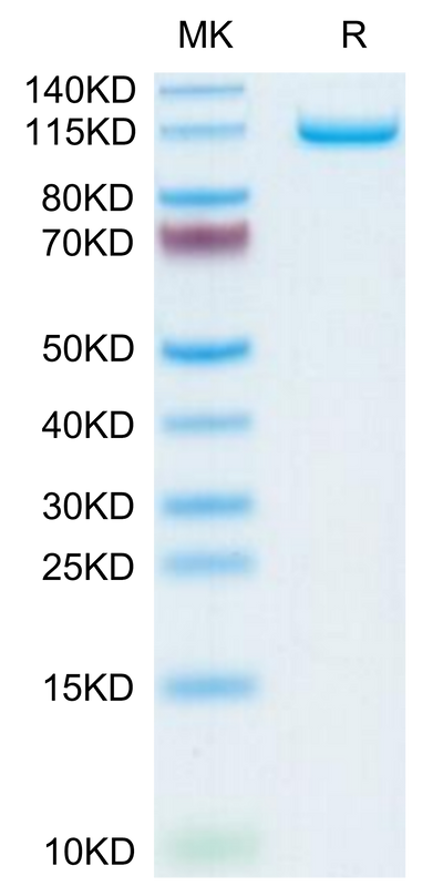 Human Neuropilin-2 on Tris-Bis PAGE under reduced condition. The purity is greater than 95%.Recombinant Human Neuropilin-2 Protein