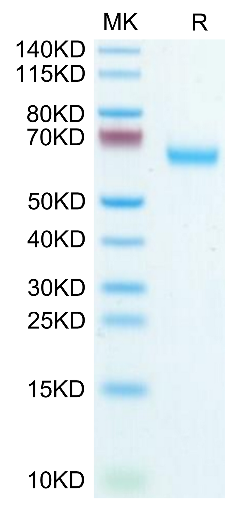 Mouse Glypican 1/GPC1 on Tris-Bis PAGE under reduced condition. The purity is greater than 95%.Recombinant Mouse Glypican 1/GPC1 Protein