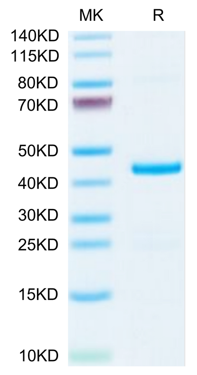 Mouse EMAP-II/AIMP1 on Tris-Bis PAGE under reduced condition. The purity is greater than 95%.Recombinant Mouse EMAP-II/AIMP1 Protein