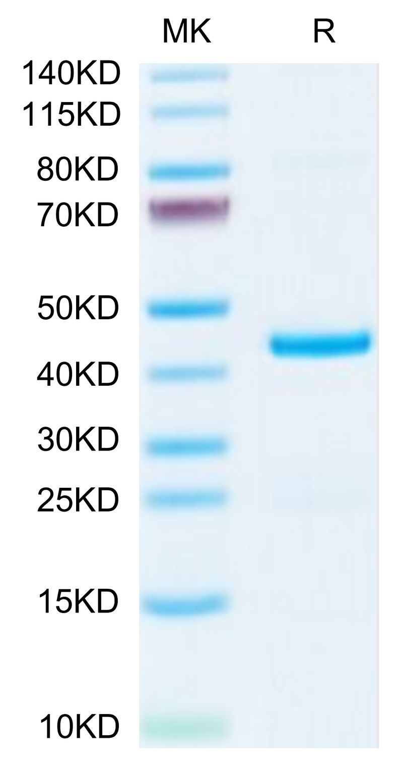 Mouse EMAP-II/AIMP1 on Tris-Bis PAGE under reduced condition. The purity is greater than 95%.Recombinant Mouse EMAP-II/AIMP1 Protein