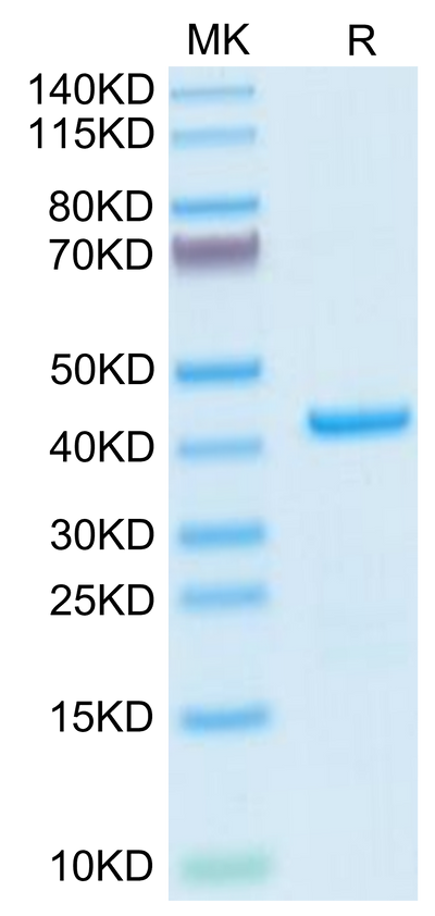 Human EMAP-II on Tris-Bis PAGE under reduced condition. The purity is greater than 95%.Recombinant Human EMAP-II/AIMP1 Protein, Active