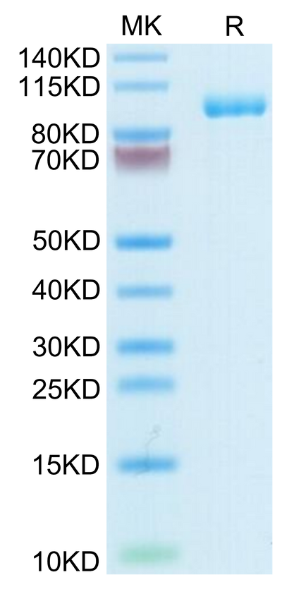 Human Thyroid Peroxidase on Tris-Bis PAGE under reduced condition. The purity is greater than 95%.Recombinant Human Thyroid Peroxidase Protein