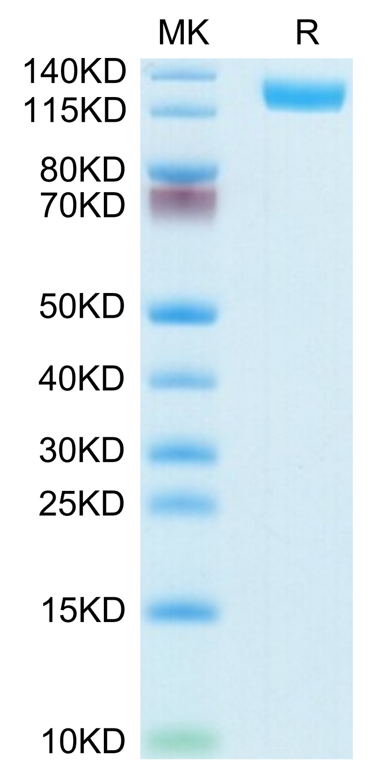 Mouse CD13/ANPEP on Tris-Bis PAGE under reduced condition. The purity is greater than 95%.Recombinant Mouse CD13/ANPEP Protein