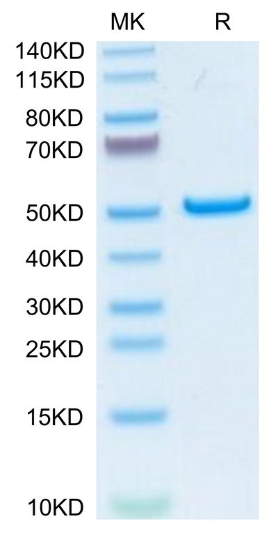 Human PLA2G1B on Tris-Bis PAGE under reduced condition. The purity is greater than 95%.Recombinant Human PLA2G1B Protein