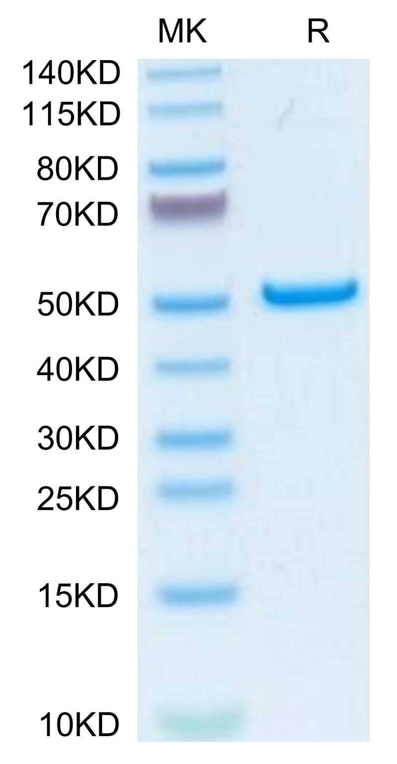 Human PLA2G1B on Tris-Bis PAGE under reduced condition. The purity is greater than 95%.Recombinant Human PLA2G1B Protein