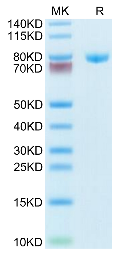 Human Transferrin on Tris-Bis PAGE under reduced condition. The purity is greater than 95%.Recombinant Human Transferrin Protein, Active
