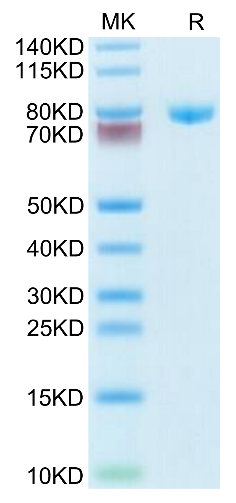 Human Transferrin on Tris-Bis PAGE under reduced condition. The purity is greater than 95%.Recombinant Human Transferrin Protein, Active