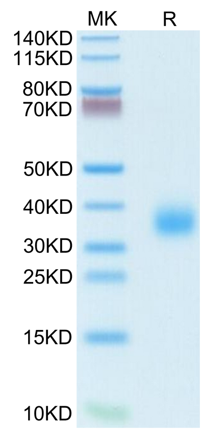 Human/Cynomolgus/Rhesus macaque ROR1 (39-151, Ig-like Domain) on Tris-Bis PAGE under reduced condition. The purity is greater than 95%.Recombinant Human/Cynomolgus/Rhesus macaque ROR1 (39-151, Ig-like Domain) Protein, Active