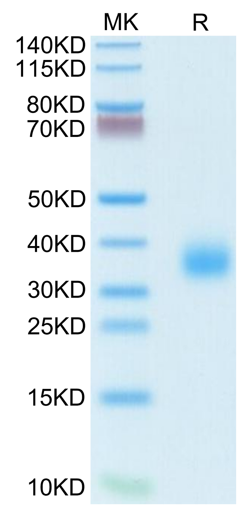 Human/Cynomolgus/Rhesus macaque ROR1 (39-151, Ig-like Domain) on Tris-Bis PAGE under reduced condition. The purity is greater than 95%.Recombinant Human/Cynomolgus/Rhesus macaque ROR1 (39-151, Ig-like Domain) Protein, Active