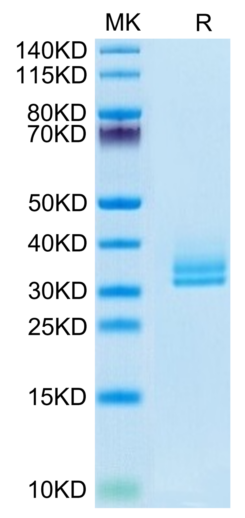 Biotinylated Human ANGPTL2 on Tris-Bis PAGE under reduced condition. The purity is greater than 95%.Biotinylated Human ANGPTL2/Angiopoietin-like 2 Protein, Active