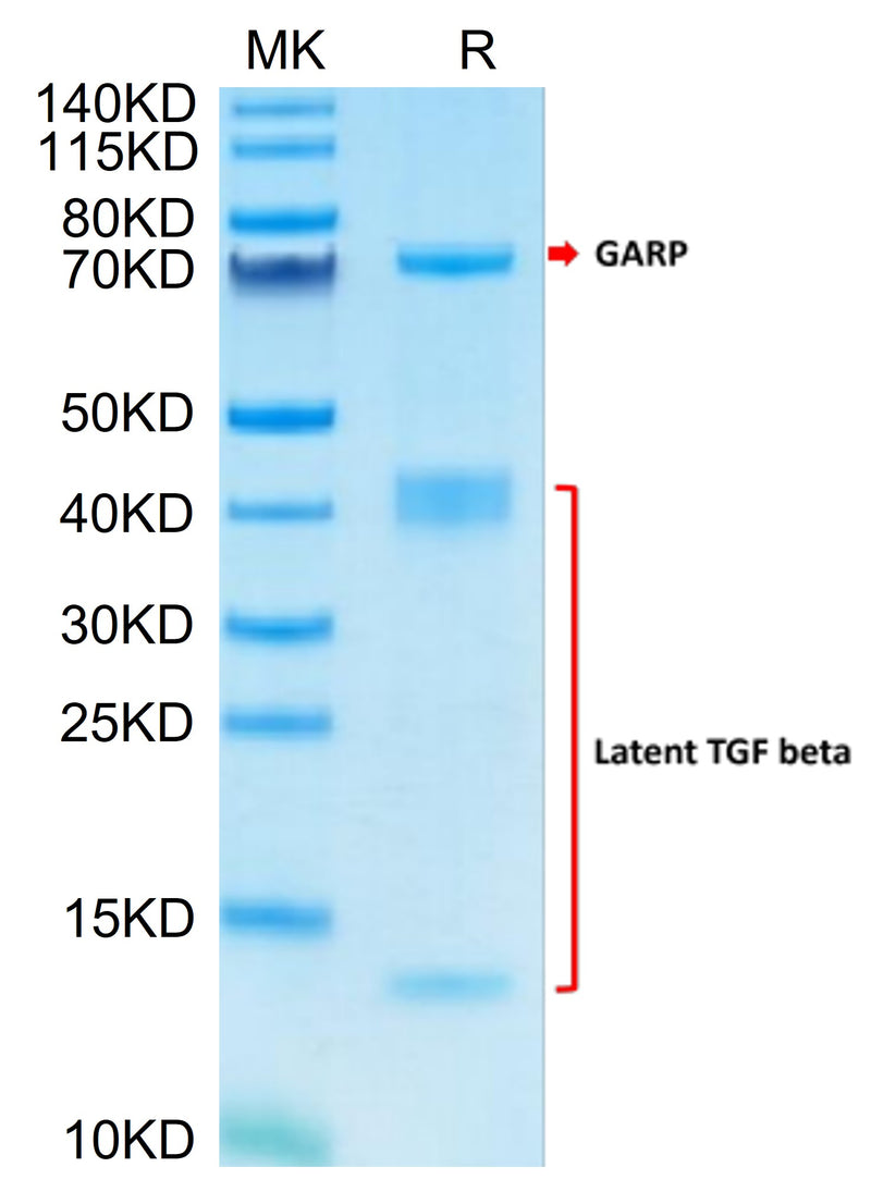 Human GARP (Y137H) &Latent TGF Beta 1 Complex on Tris-Bis PAGE under reduced condition. The purity is greater than 95%.Recombinant Human GARP (Y137H) &Latent TGF Beta 1 Complex Protein, Active