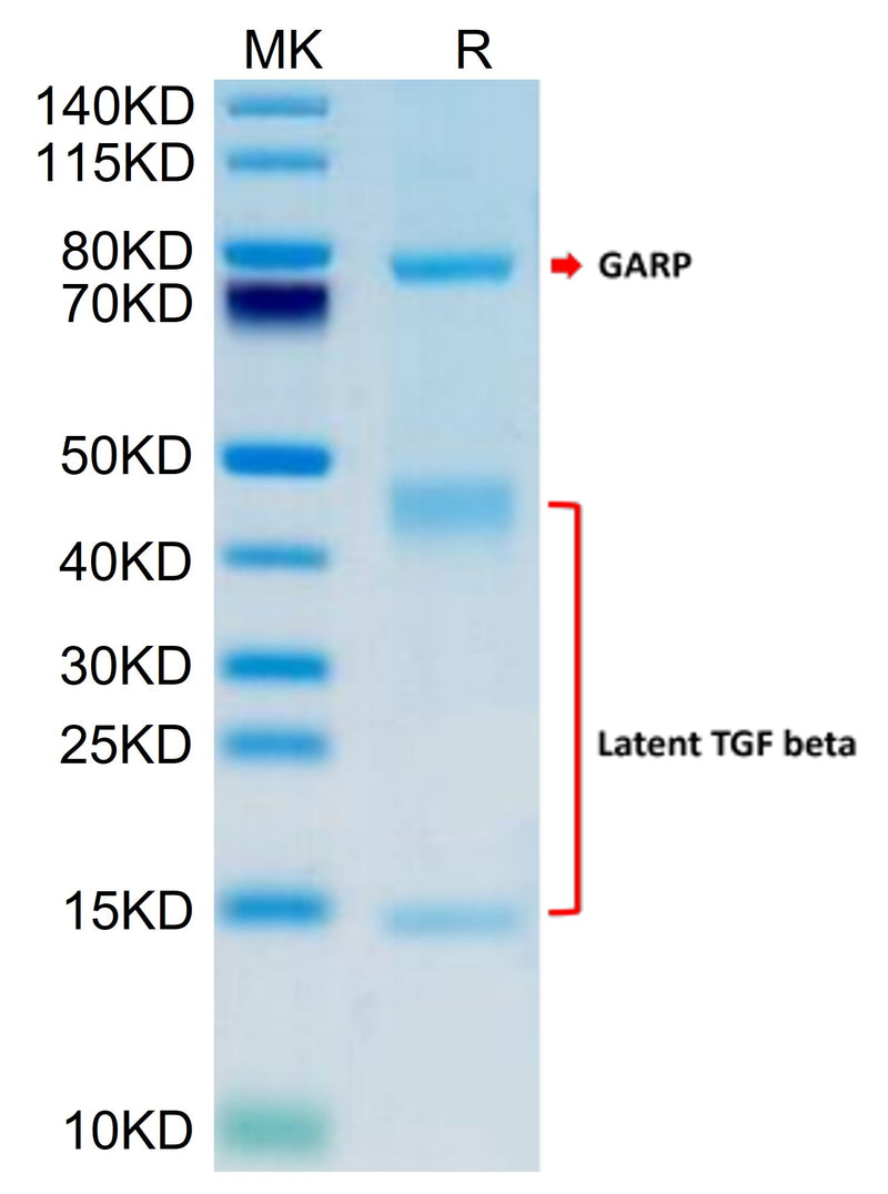Human GARP (S138G) &Latent TGF Beta 1 Complex on Tris-Bis PAGE under reduced condition. The purity is greater than 95%.Recombinant Human GARP (S138G) &Latent TGF Beta 1 Complex Protein