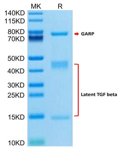 Human GARP (G139N) &Latent TGF Beta 1 Complex on Tris-Bis PAGE under reduced condition. The purity is greater than 95%.Recombinant Human GARP (G139N) &Latent TGF Beta 1 Complex Protein, Active