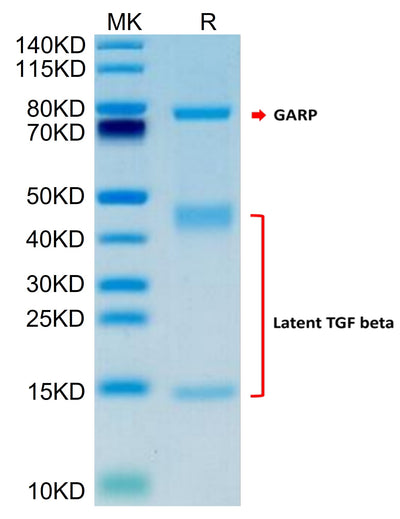 Human GARP (Y137H&S138G&G139N) &Latent TGF Beta 1 Complex on Tris-Bis PAGE under reduced condition. The purity is greater than 95%.Recombinant Human GARP (Y137H&S138G&G139N) &Latent TGF Beta 1 Complex Protein