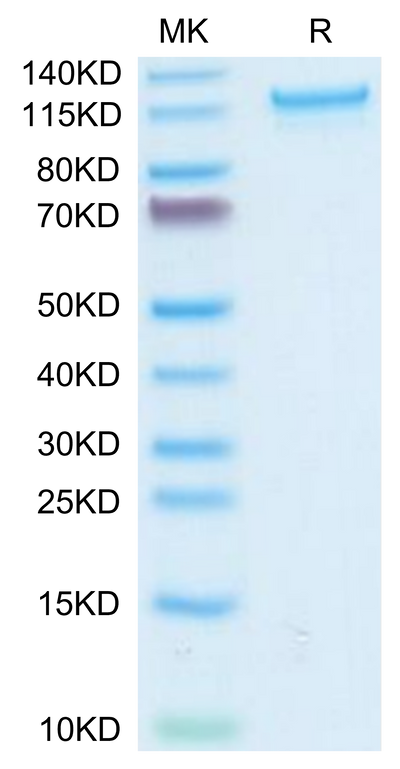 Human CD93 on Tris-Bis PAGE under reduced condition. The purity is greater than 95%.Recombinant Human CD93/C1q R1 Protein, Active
