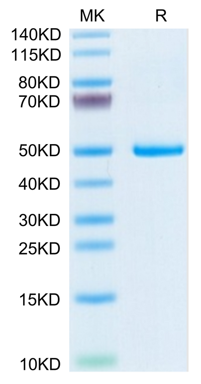 Mouse PLA2G1B on Tris-Bis PAGE under reduced condition. The purity is greater than 95%.Recombinant Mouse PLA2G1B Protein