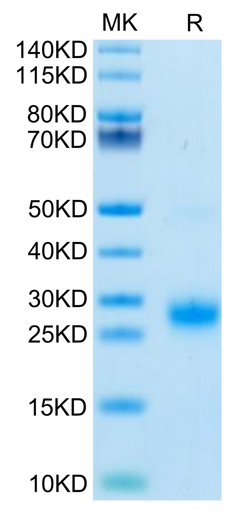 Biotinylated Human GITR on Tris-Bis PAGE under reduced condition. The purity is greater than 95%.Biotinylated Human GITR/TNFRSF18 Protein, Active