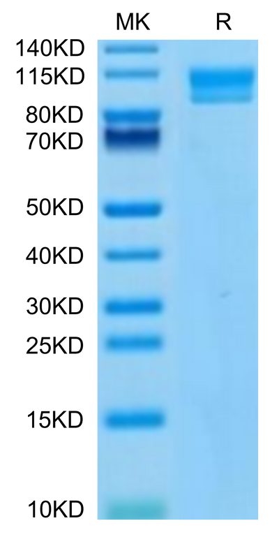 Human IL-17Rc on Tris-Bis PAGE under reduced condition. The purity is greater than 95%.Recombinant Human IL-17Rc Protein, Active