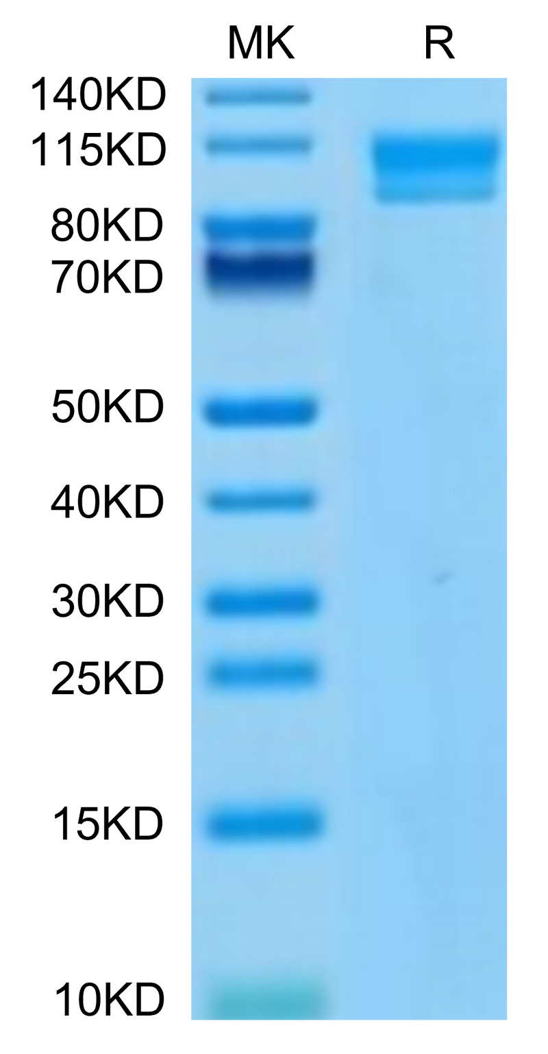 Human IL-17Rc on Tris-Bis PAGE under reduced condition. The purity is greater than 95%.Recombinant Human IL-17Rc Protein, Active