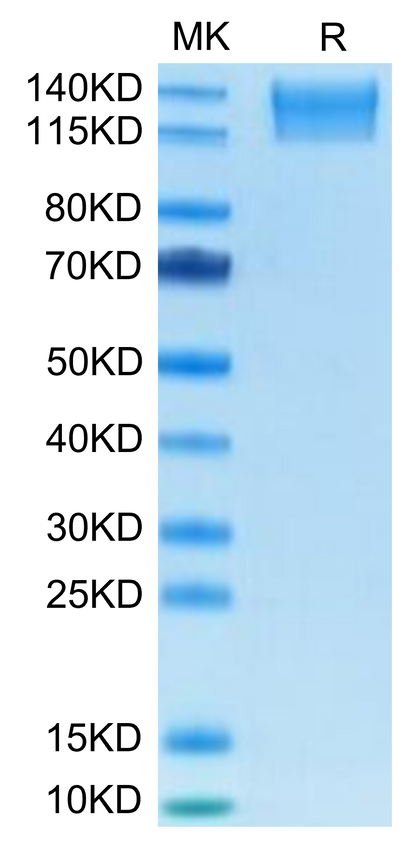 Mouse SEZ6L2 on Tris-Bis PAGE under reduced condition. The purity is greater than 95%.Recombinant Mouse SEZ6L2 Protein