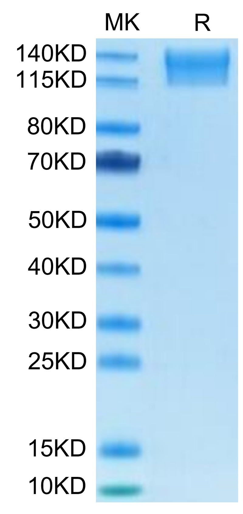 Mouse SEZ6L2 on Tris-Bis PAGE under reduced condition. The purity is greater than 95%.Recombinant Mouse SEZ6L2 Protein