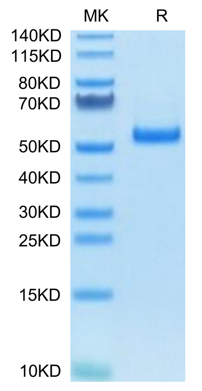 Human PLAU (pro form) on Tris-Bis PAGE under reduced condition. The purity is greater than 95%.Recombinant Human PLAU/uPA Protein (pro form), Active