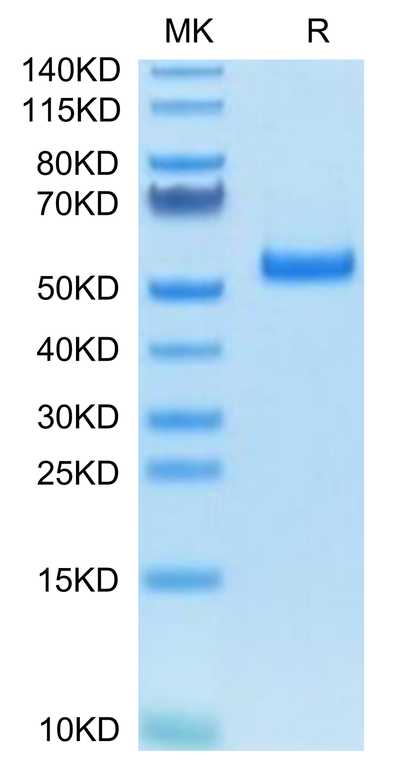 Human PLAU (pro form) on Tris-Bis PAGE under reduced condition. The purity is greater than 95%.Recombinant Human PLAU/uPA Protein (pro form), Active