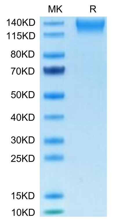 Human SEZ6L2 on Tris-Bis PAGE under reduced condition. The purity is greater than 95%.Recombinant Human SEZ6L2 Protein