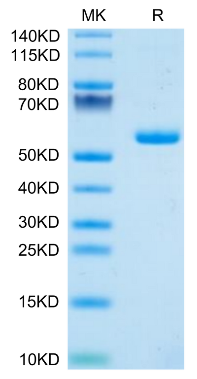 Human PGLYRP1 on Tris-Bis PAGE under reduced condition. The purity is greater than 95%.Recombinant Human PGLYRP1 Protein, Active