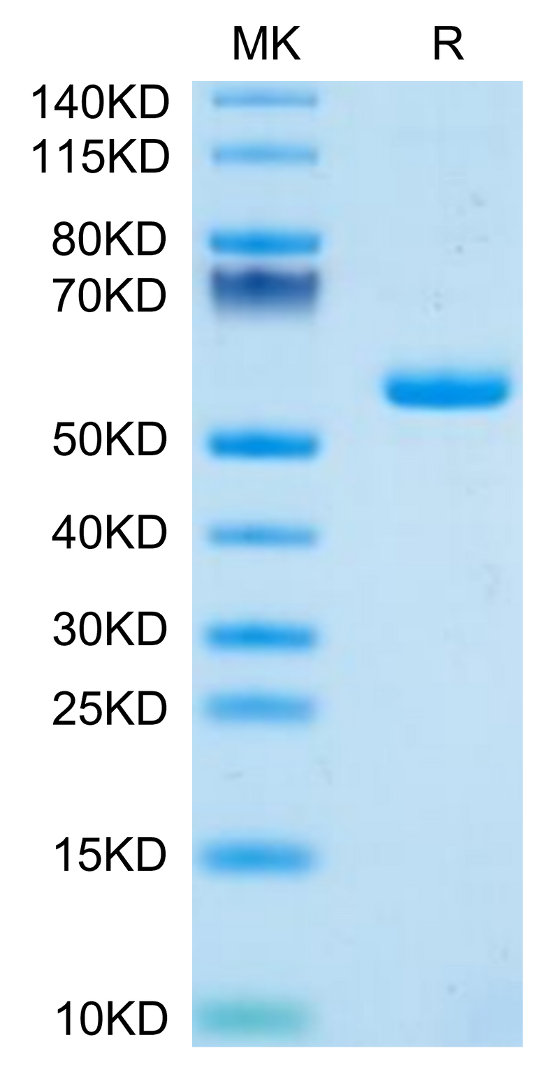 Human PGLYRP1 on Tris-Bis PAGE under reduced condition. The purity is greater than 95%.Recombinant Human PGLYRP1 Protein, Active